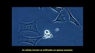 Morte Celular Programada Apoptose  Vídeo sob Microscópio Legendado [upl. by Eentroc265]