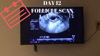 DAY 12 FOLLICLE SCAN [upl. by Inasah]