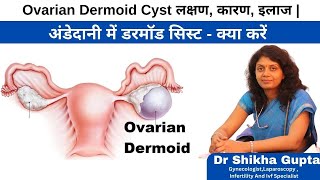 DERMOID CYST IN HINDI  Ovarian Dermoid Cyst लक्षण कारण इलाज [upl. by Aicela435]