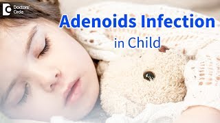 Infected adenoids in children Signs Symptoms Diagnosis  Dr Satish Babu K [upl. by Ayit]