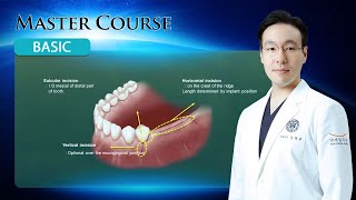 Master Course  BASIC Flap Design Instrument for Elevation [upl. by Suolevram222]