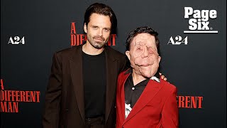 Sebastian Stan slams reporter for describing costar Adam Pearson as a ‘beast’ over disfigurement [upl. by Sakhuja]