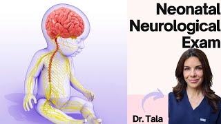 How to perform the NEURO exam on a baby HeadtoToe CNS evaluation [upl. by Flynn]