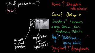 Idiopathic osteosclerosis [upl. by Ingemar791]