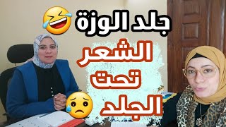 التخلص من الشعر تحت الجلد علاج جلد الوزة😪نصائح للمراهقات والعرايس [upl. by Fullerton]