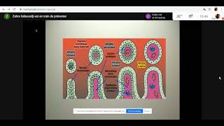 Gynéco  12 La maladie trophoblastique gestationnelle MTG Tizi Dr Saboundji [upl. by Slohcin625]