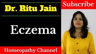 एक्जिमा का इलाज  Homeopathic Medicine amp Treatment For Eczema in Hindi How to cure eczema fast [upl. by Maxa]