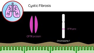 Cystic Fibrosis [upl. by Nnylaj720]