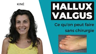 Traitement hallux valgus sans chirurgie [upl. by Annat895]