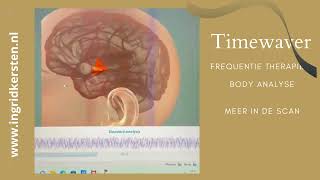 Aflevering 7 Timewaver frequentie Therapie [upl. by Dougy]