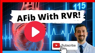 AFib with RVR Symptoms and Treatment [upl. by Emmalee]