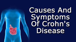 Causes and Symptoms Of Crohns Disease [upl. by Merwyn737]