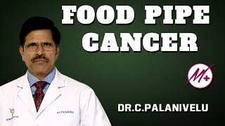 Adenocarcinoma  Food Pipe Cancer  Esophageal Cancer   DrCPalanivelu [upl. by Len521]