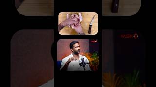 Skinless vs SkinOn Which Chicken Wins  Telugu Podcast  Voice of Mogasala [upl. by Eelymmij]