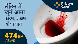 लैट्रिन में खून आना  कारण लक्षण और इलाज  Blood in Stool For Free appointment call 9821388242 [upl. by Rust673]