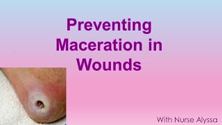 Preventing Maceration in wounds [upl. by Enidlarej]