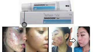 NADOXIN Gel Nadifloxacin 1 Gel [upl. by Laven910]