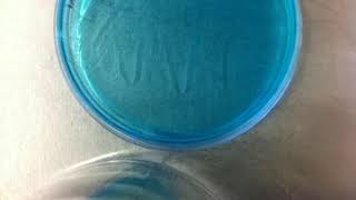 microbial growth  timelapse video [upl. by Paluas]