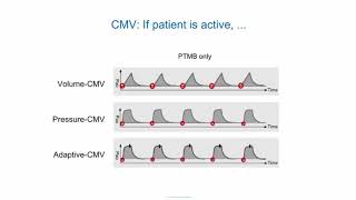 eLearning Ventilation modes ABC [upl. by Rosalynd]