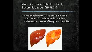 Fatty Liver The Silent Epidemic [upl. by Onaimad723]