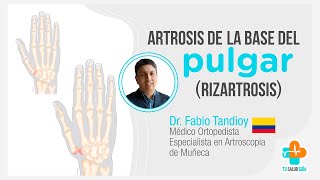 ARTROSIS de la base del pulgar Rizartrosis  Tu Salud Guía [upl. by Seuqramed569]