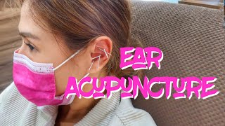 EAR AURICULAR ACUPUNCTURE TO REDUCE STRESS AND DETOXIFY  Valerie Tan [upl. by Harbed]