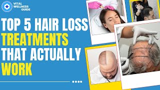 Top 5 Hair Loss Treatments That Actually Work  Vital Wellness Guide [upl. by Alioz823]