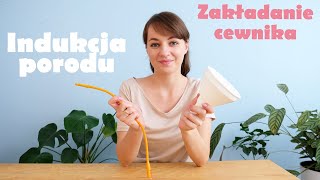 INDUKCJA  wywoływanie porodu zakładanie cewnika  WomanStory [upl. by Llertal994]