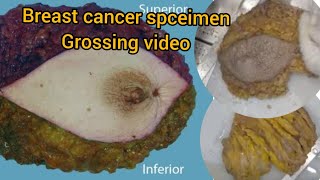 Breast cancer spceimen grossing video😨 museum specimen histo baby biopsy cancer breastcancer [upl. by Blayze]