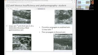 Venous Plethysmography [upl. by Adnopoz894]