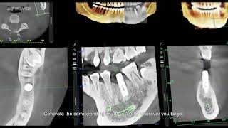 Meyer 3D Pro Mydent Viewer© yazılımı kullanım ve fonksiyonlar [upl. by Zara]