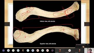 Bones of Upper Limb  Practical Anatomy  MBBS Lecture [upl. by Hsetirp31]