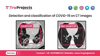 Detection and classification of COVID 19 on CT Images Copy [upl. by Noffets]