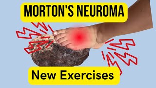 Mortons neuroma The First Exercises To Start With [upl. by Ahsinrad]