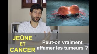 Jeûne et cancer  Peuton vraiment affamer les tumeurs [upl. by Adali]