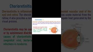 Chorioretinitis  Inflammation of Choroid and Retina [upl. by Bergmans]