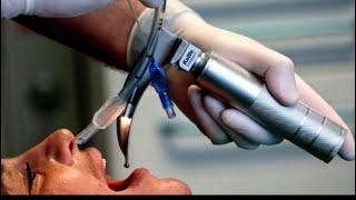 Endotracheal Tube ETT Intubation [upl. by Anrim]