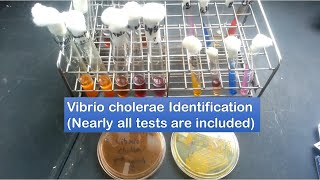 Vibrio cholerae identification  A to Z tests [upl. by Stodder]