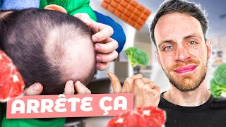 Vous perdez vos cheveux  Essayez ces 6 aliments  alopécie calvitie [upl. by Kristy466]