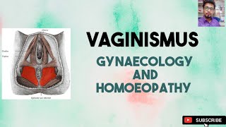 VAGINISMUS  Gynaecology and Homoeopathy2 Eng [upl. by Norha799]