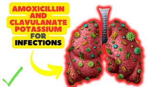 Amoxicillin and Clavulanate Potassium A DualAction Antibiotic for Bacterial Infections [upl. by Suilenrac]