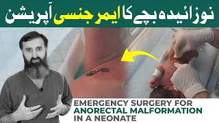 Emergency Surgery for Anorectal Malformation in a Neonate  Dr Umar Nisar [upl. by Finstad]