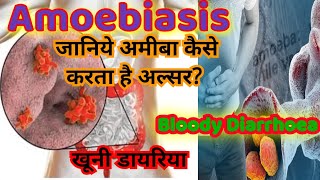 Amoebiasis pathogenesis laboratory diagnosis and treatment in hindi [upl. by Ellierim717]