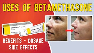 What is Uses of Betamethasone Betaderm Betnovate  betnovate c skin cream  Benefits Dosage [upl. by Eimme]