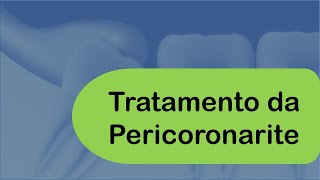 Tratamento da Pericoronarite  Odontologia  Dra Bianca Rosa [upl. by Aay]