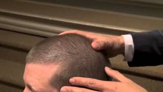 4th Annual SLU Hair Transplant Course How Hair Grows [upl. by Amersham]