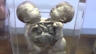 Horrifying Siriraj Medical Museum In Thailand aka the Anatomy Museum [upl. by Moia]