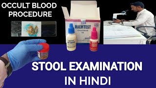 Stool Examination  Stool Microscopic Examination  माल की जांच  Stool Occult Blood Test [upl. by Ellirehs658]