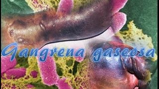 Gangrena gaseosa Clostridium perfringens [upl. by Dal]