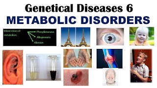 Genetical disease 6  Inborn Errors Of Metabolism  Phenylketonuria  Alkaptonuria  Albinism [upl. by Casabonne370]